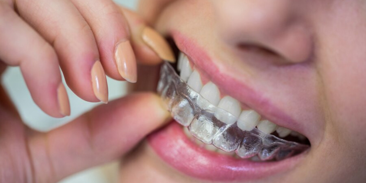 What Happens After Orthodontic Treatment?