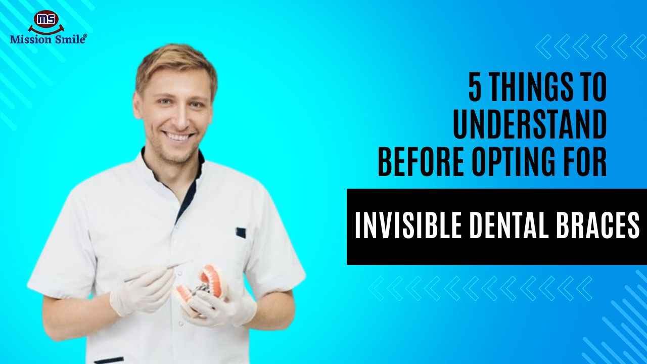 5 Things to Understand Before Opting for Invisible Braces