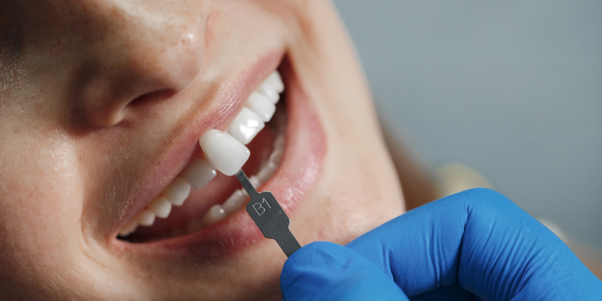 Comprehensive Guide to Dental Services: Ensuring Your Oral Health