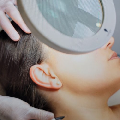 Advanced Electrolysis in Milton Keynes | Expert Treatment