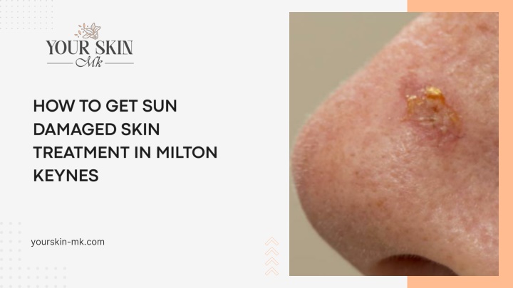 PPT - How to Get Sun Damaged Skin Treatment in Milton Keynes PowerPoint Presentation - ID:14557369