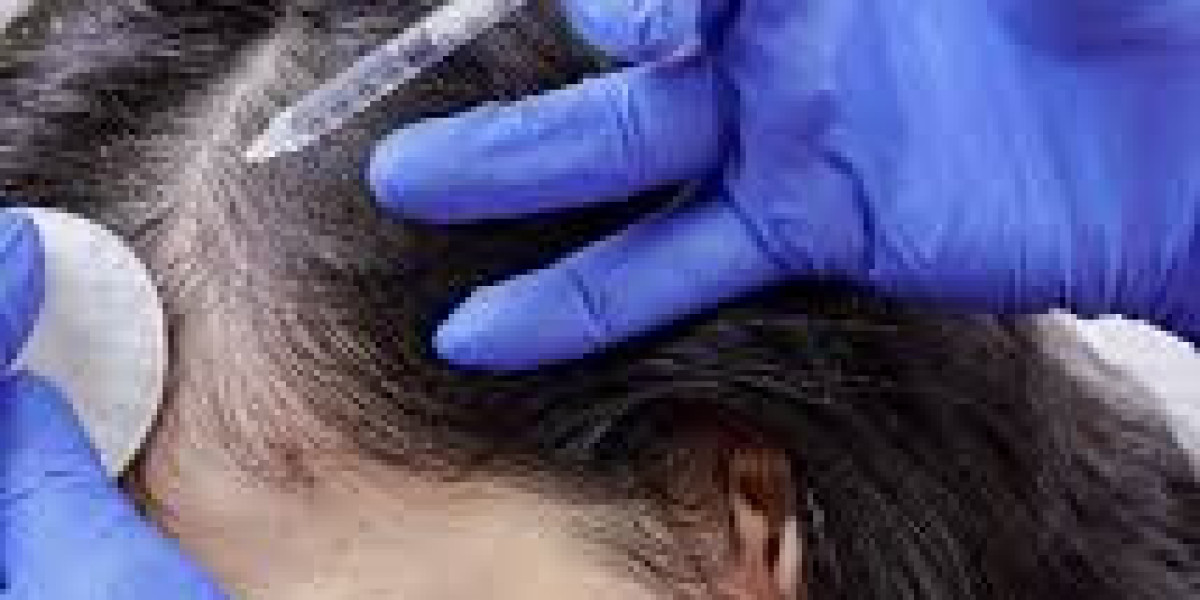 Beste klinieken voor haarvullerbehandelingen in Rotterdam