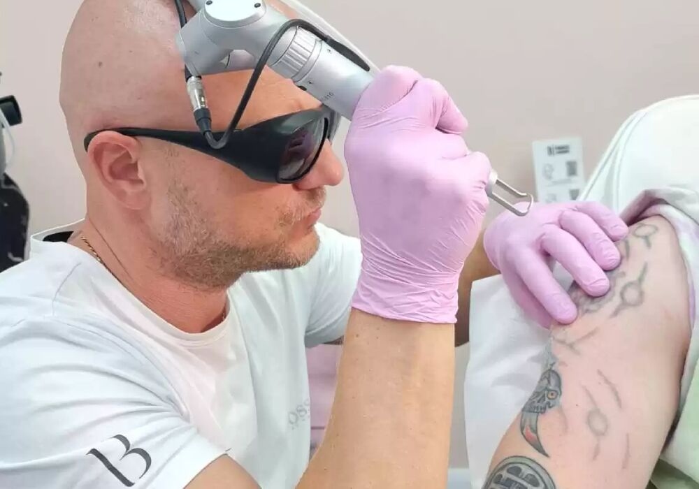 Tattoo Removal vs Tattoo Cover-Up: Which is Right for You?