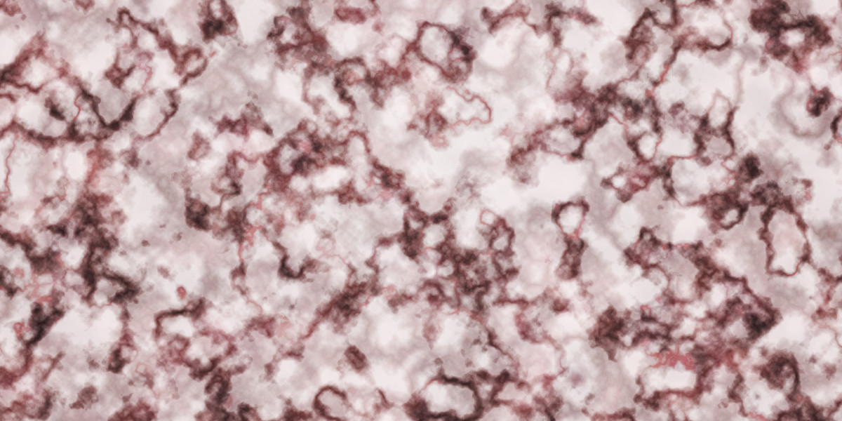 Rising Treatment Options For Erectile Dysfunction: A Complete Study