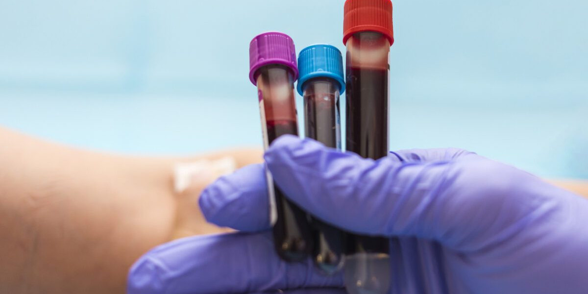 Can Hepatitis B Testing Be Done at Home?