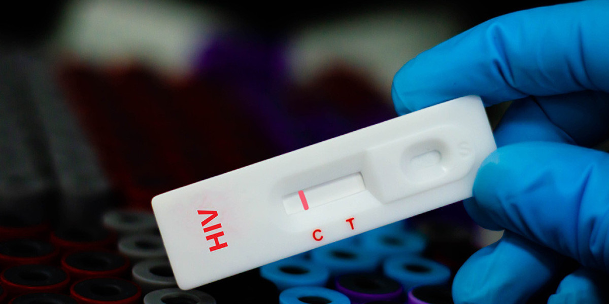 How Soon After Exposure Should You Test for HIV?