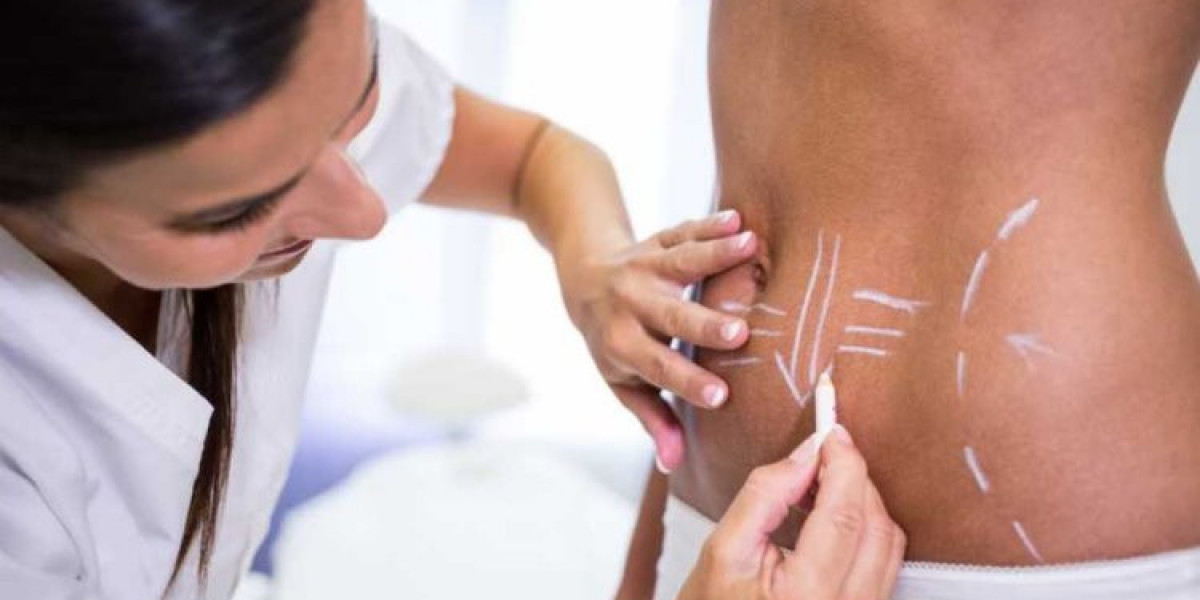 Best Body Contouring Techniques in Islamabad Compared