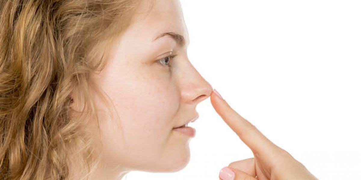 What Proportions Define Ideal Rhinoplasty?