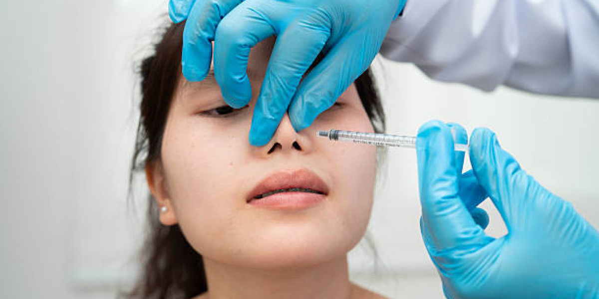 Can Rhinoplasty Refine Droopy Tips?