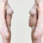 Liposuction in Riyadh Saudi Profile Picture