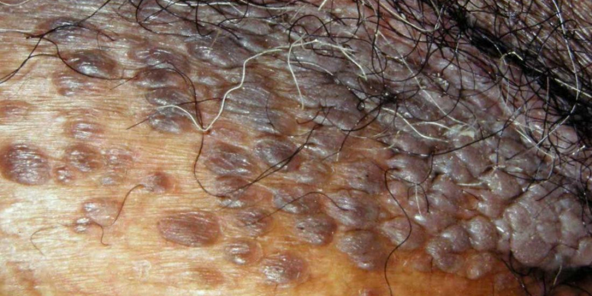 UGV Spot Treatment: Modern Vaginal Therapy for Sensation, Comfort, and Confidence