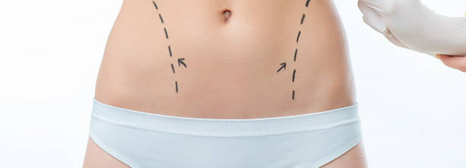 Liposuction in Riyadh Saudi Cover Image