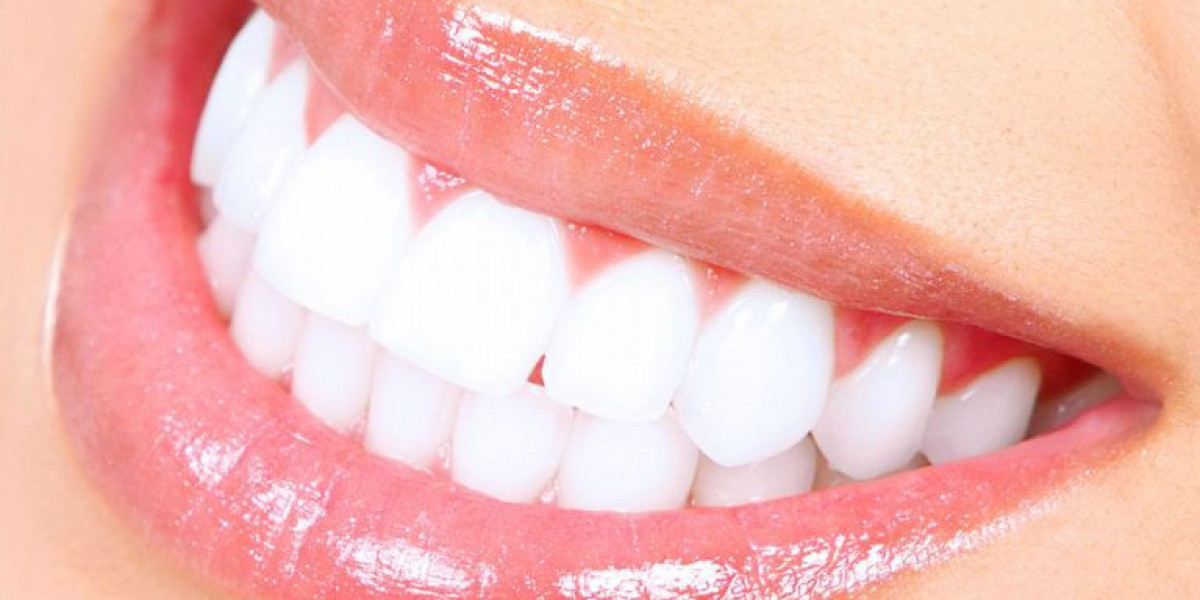 Common Myths About Teeth Whitening Debunked