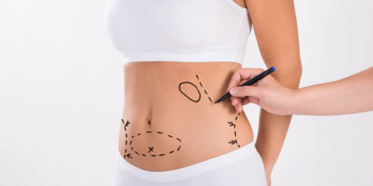 How Choose Right Liposuction Procedure Type?
