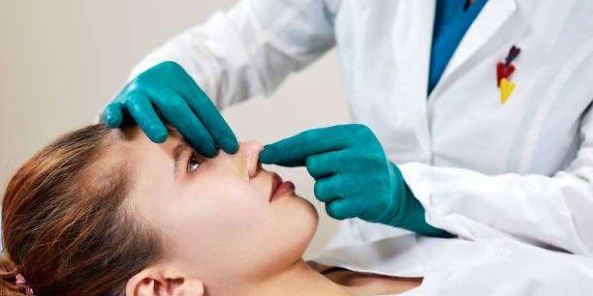 Rhinoplasty: Explained for Facial Feature Enhancement