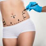 Liposuction procedure in Riyadh Profile Picture