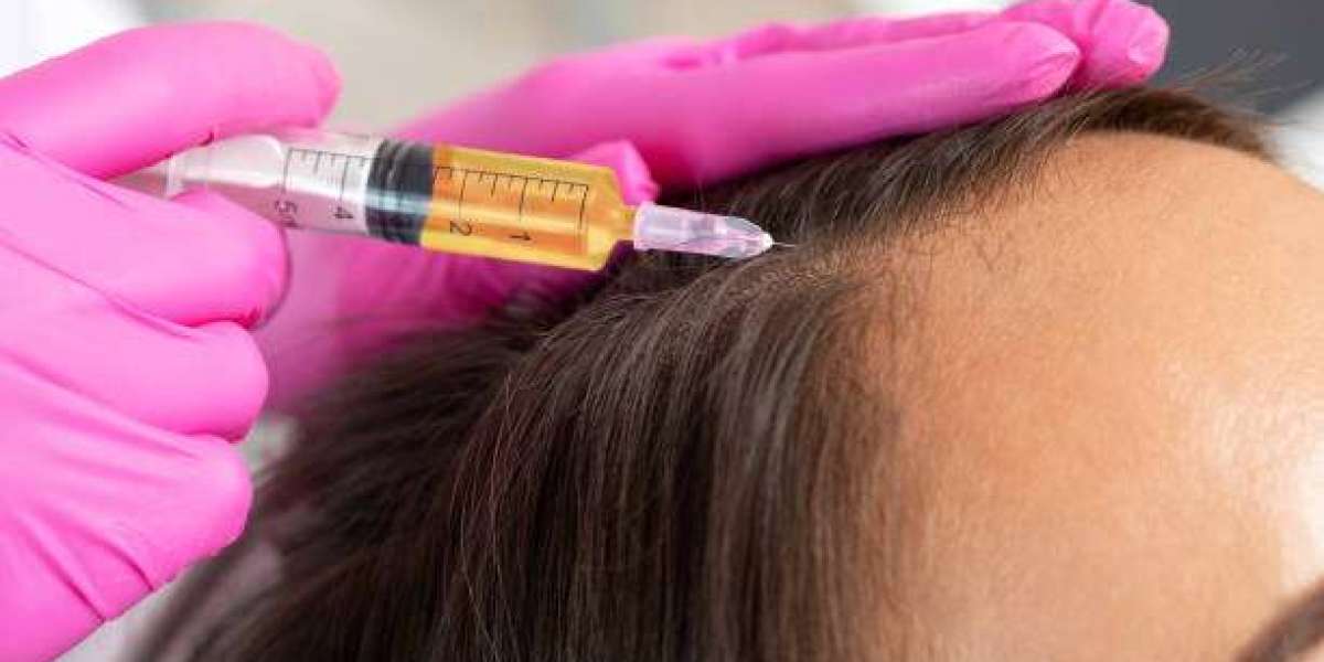 PRP Hair Treatment vs Traditional Hair Loss Solutions