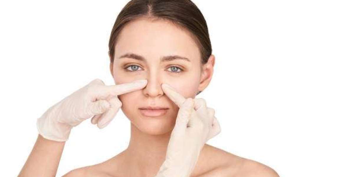 Long-Term Rhinoplasty Effects: Maintaining Your New Nose Shape