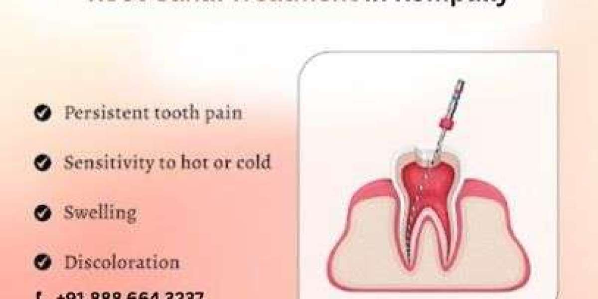 The Truth About Root Canal Treatment at FMS Dental Kompally : Why It’s Not as Scary as You Think
