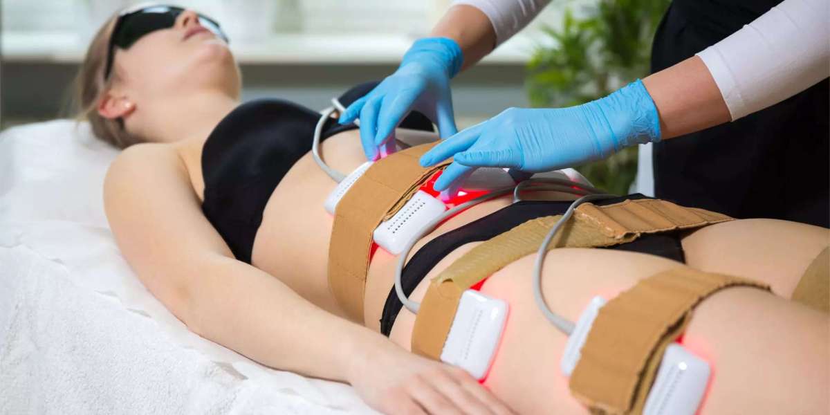 Laser Liposuction Dubai: Techniques for Stubborn Fat