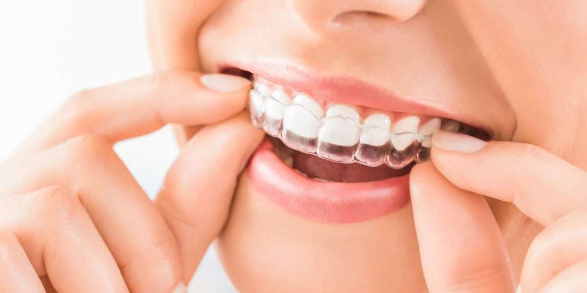Dental Aligners in Dubai: Travel-Friendly Care Tips