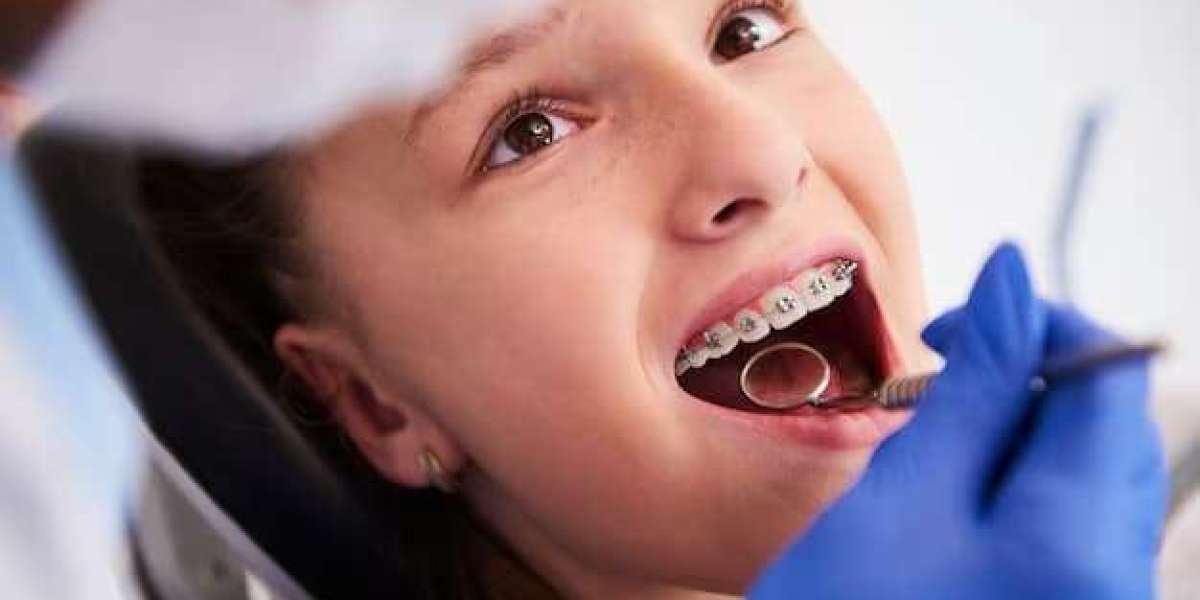 A Complete Guide to Finding Quality Teeth Braces Near Me