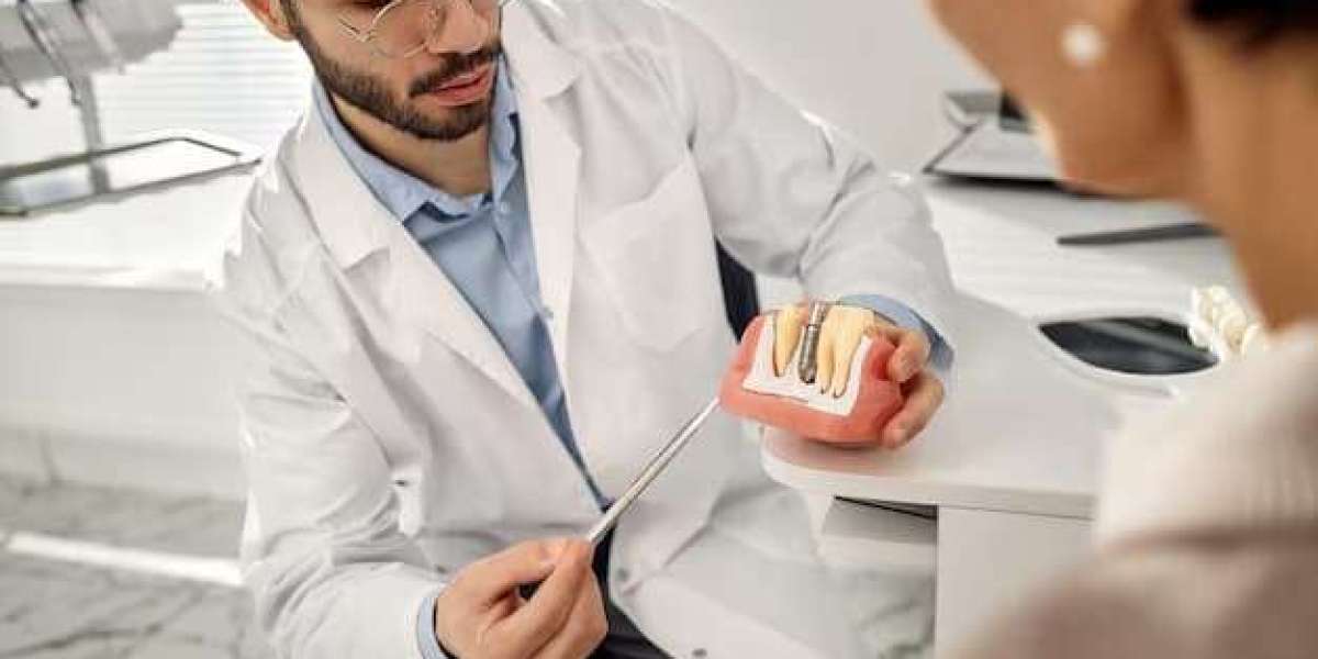 Choosing the Best Dental Implants in Riverpark