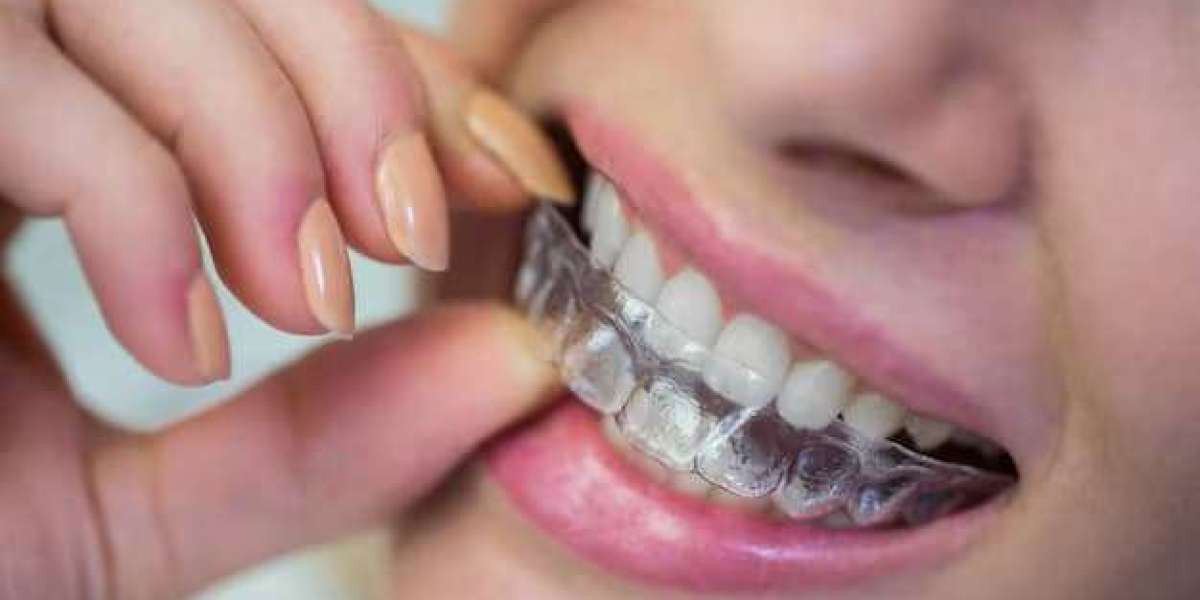 Success Stories Invisalign Treatment in Ventura