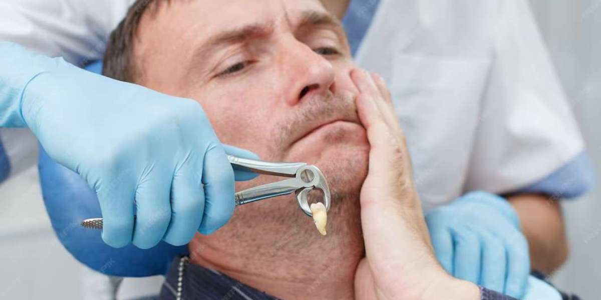 Tooth Extraction Beverly Hills for Damaged Teeth