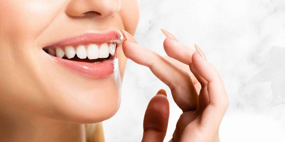 How to Care for Veneers in Dubai: Tips for Longevity