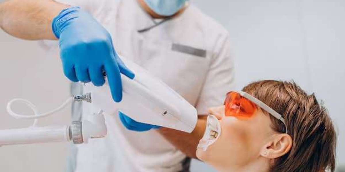 Professional vs DIY Teeth Whitening in Rickmansworth: What Works Best?