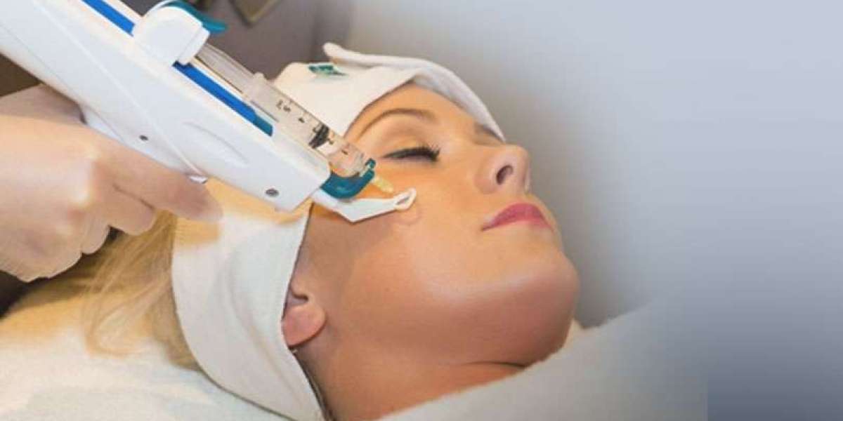 Can Mesotherapy Give You Younger Looking Skin Without Complex Steps