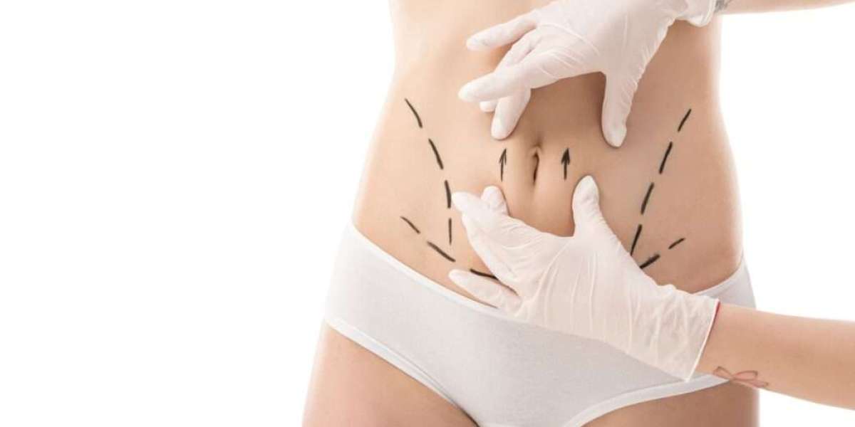 Can Vaser 4D Liposuction Carve Out Sculpted Abs and Sharper Curves