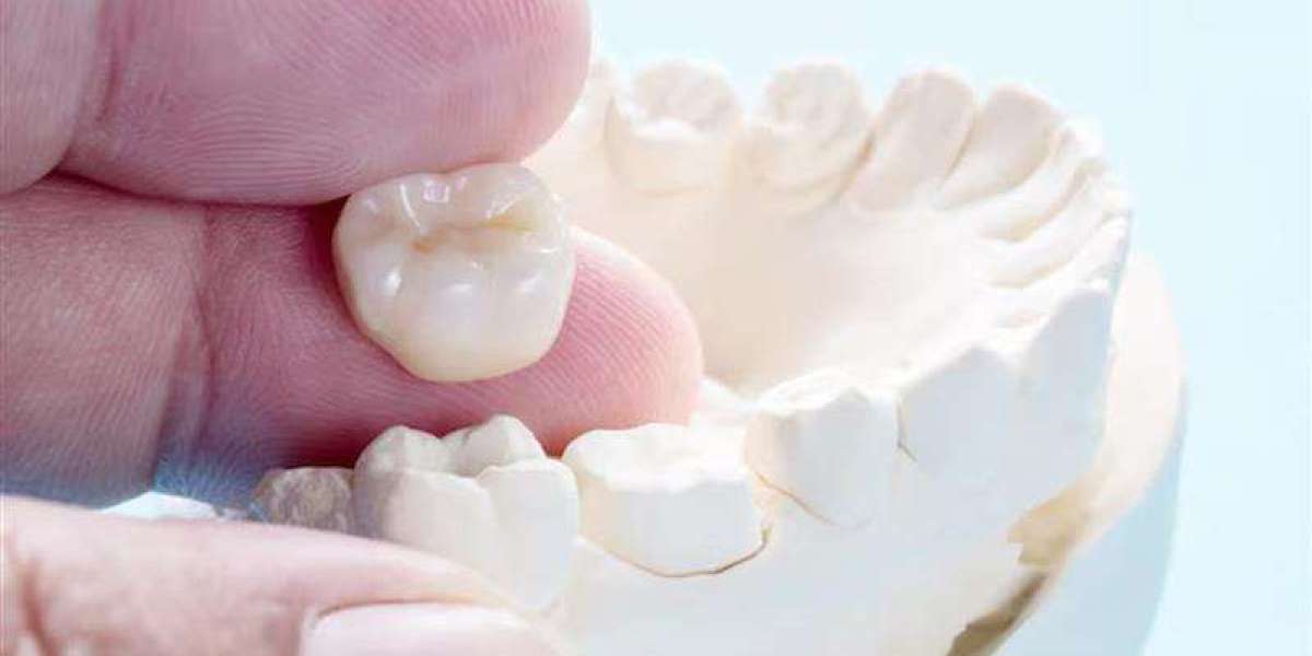 How 3D Printing Is Transforming Leamington Spa Dental Crowns