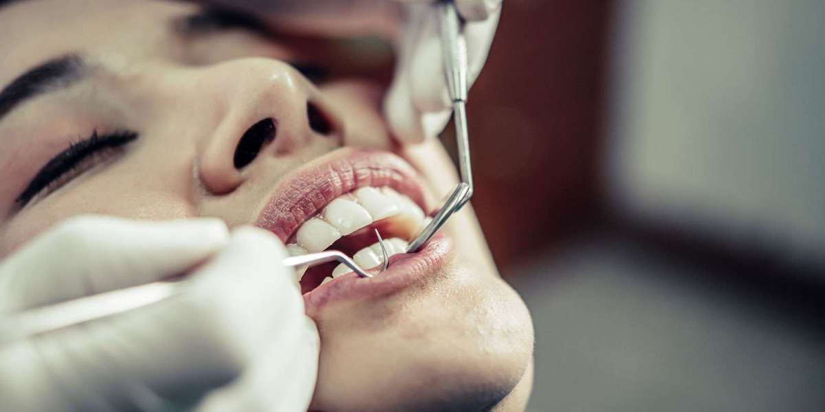 Dental Tooth Filling Final Thoughts and Expert Summary