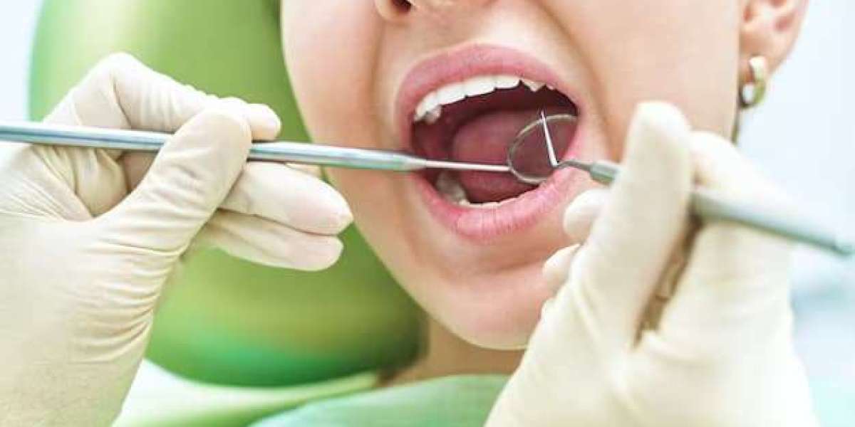 Dental Sealant Near Me: What You Should Know Before Getting One