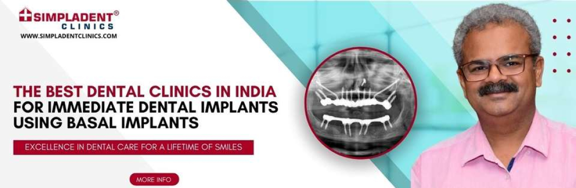 Full Mount Dental Implants Cover Image