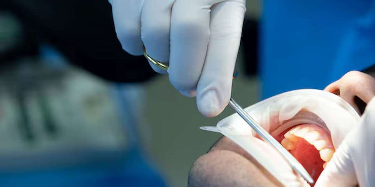 Sherman Oaks Oral Surgeons: Services Explained