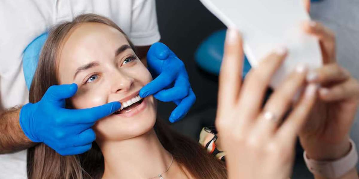 How to Find the Best Dental Bonding Near Me