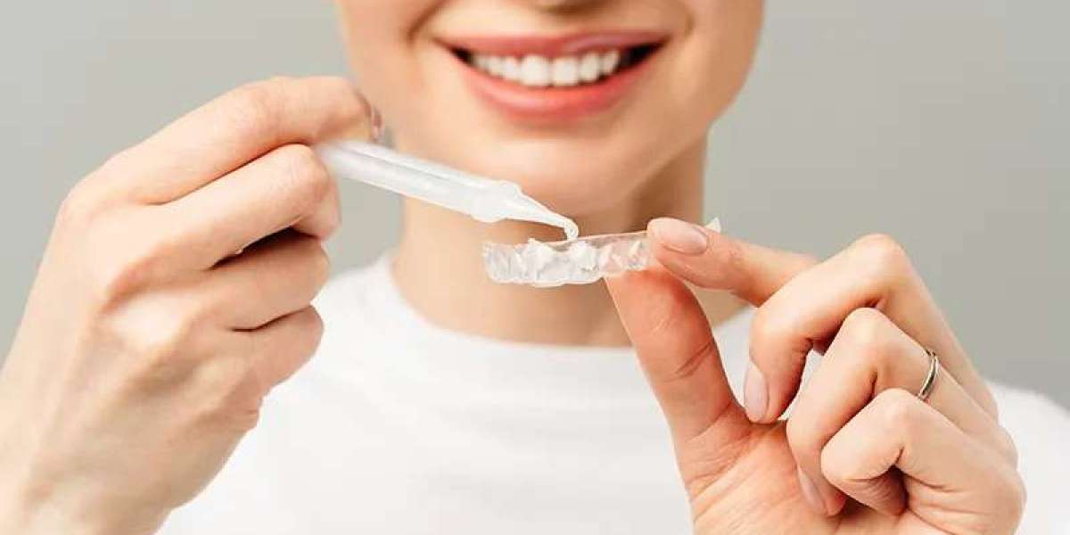 Can Teeth Whitening Fix Dull Smiles?