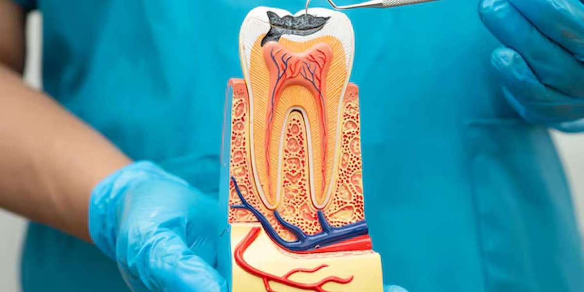 Root Canal Treatments vs Tooth Extraction