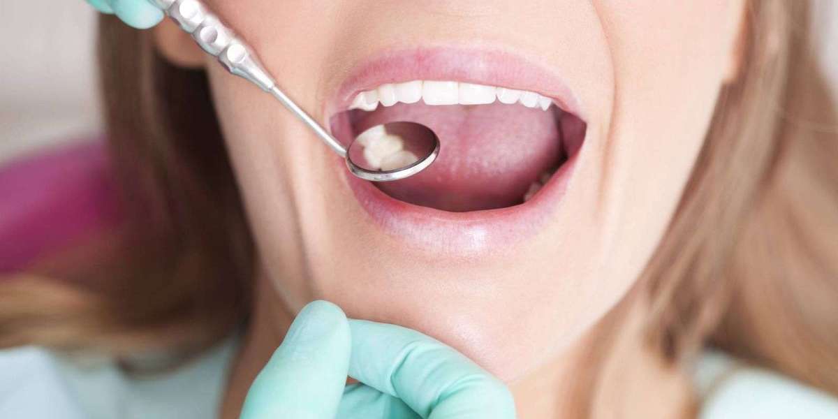 Dental tooth filling: Quick Fix for Cavities