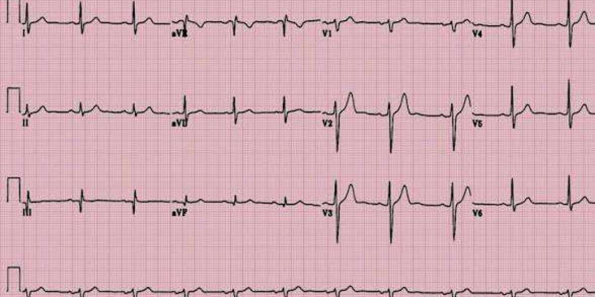How the Right ECG Course Training Changes What You See on Every Strip