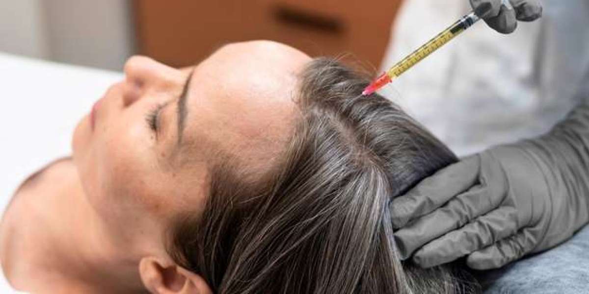 Elite transformation with Exosomes For Hair Loss that inspires new hair life