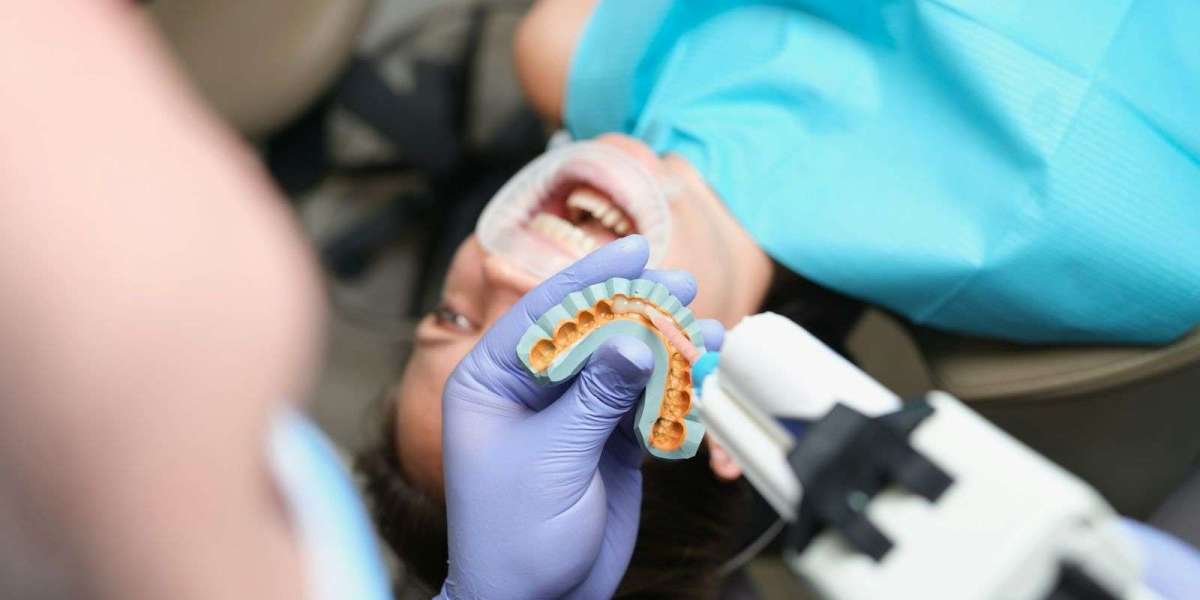 Veneers in Dubai Maintenance and Care Guide