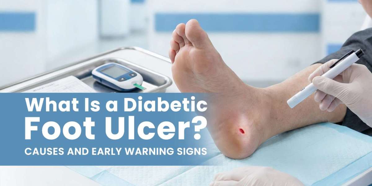 A Complete Guide to Diabetic Foot Ulcers and Prevention Tips