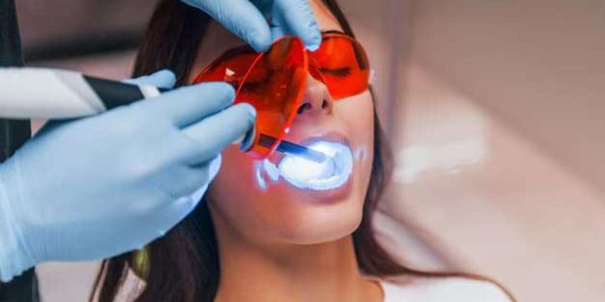 Professional Teeth Cleaning in Beverly Hills: What You Should Know