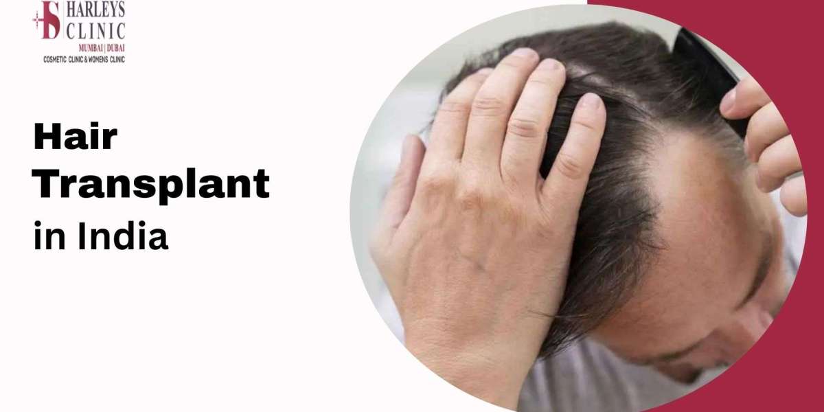 Things You Should Know About Hair Transplant Expenses