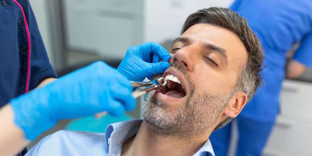 Wisdom Teeth Removal: What You Need to Know