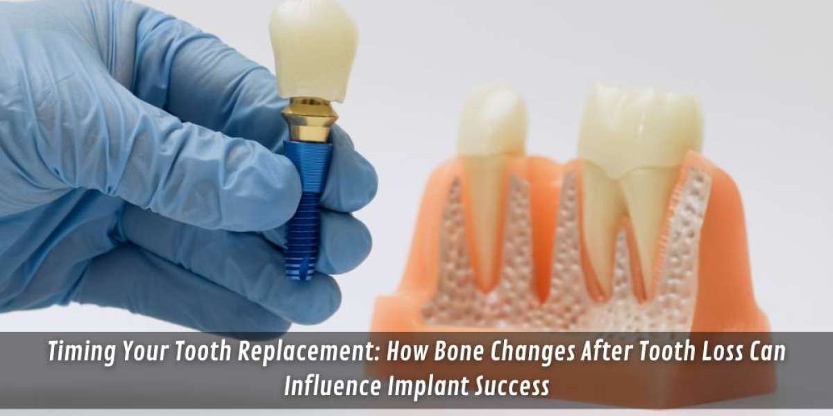 Timing Your Tooth Replacement: How Bone Changes After Tooth Loss Can Influence Implant Success